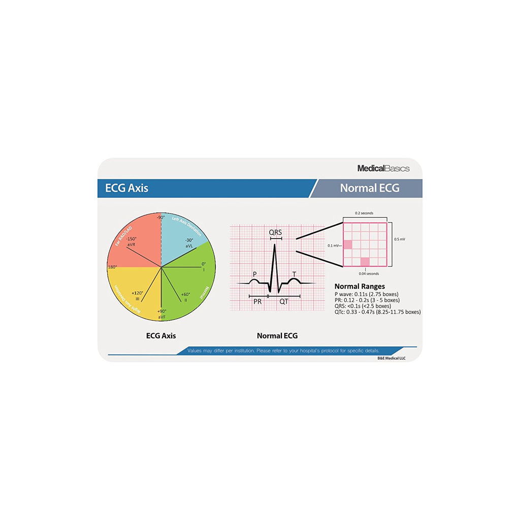 EKG - Scrubnotes Reference Sheet